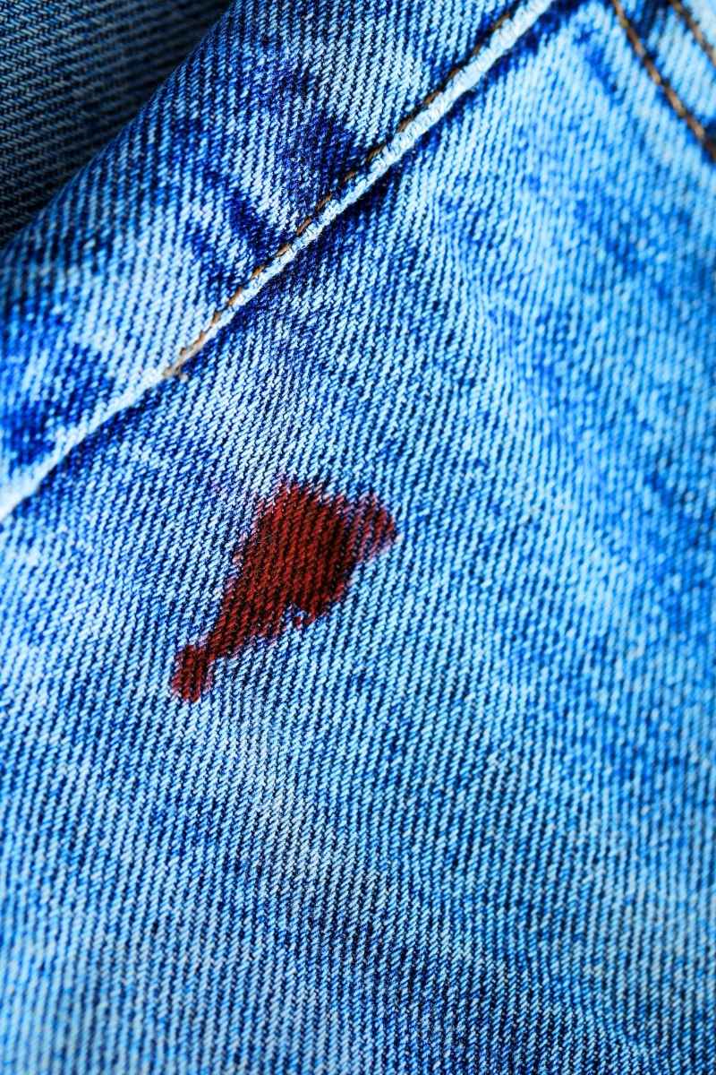 Limpieza de ropa mancha de sangre